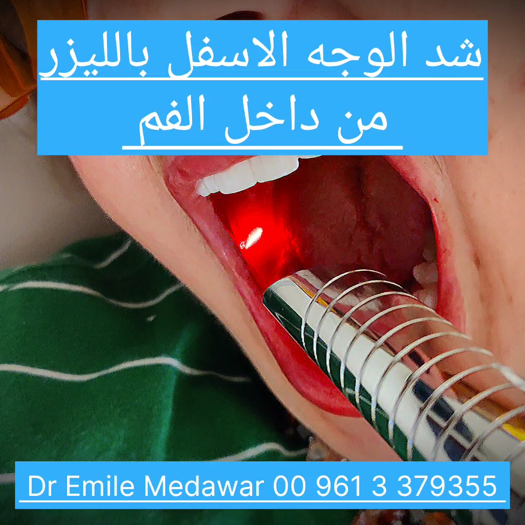 Laser facelift non-surgical skin tightening Lebanon